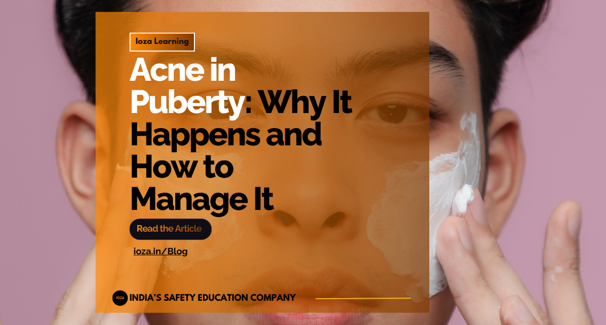 Acne in Puberty: Why It Happens and How to Manage It